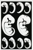 Thumbnail for Untitled (Fetus printed …