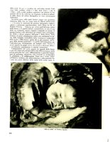 Child thumbnail