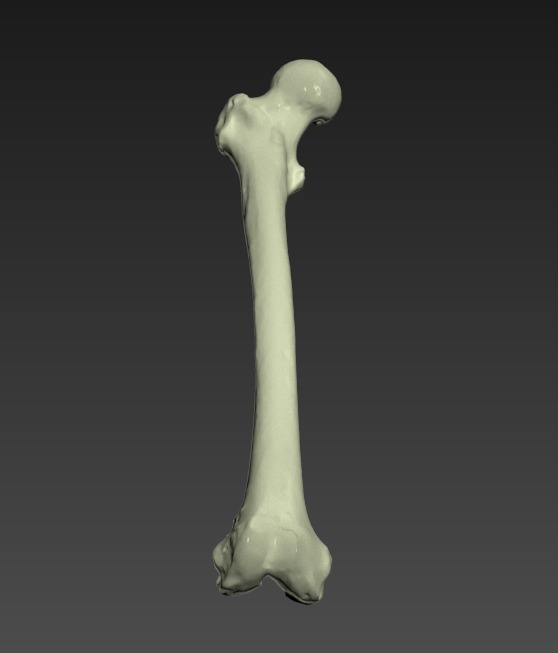 Thumbnail for Extremity-Femur