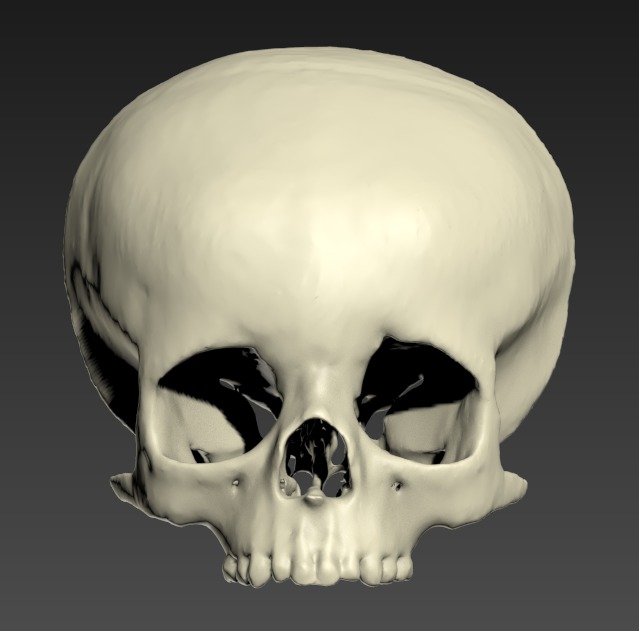 Thumbnail for Head-Pediatric-Facial-Bones