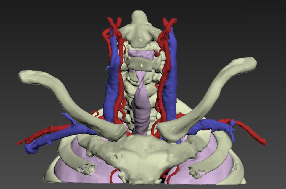 Thumbnail for Neck-Cervical-Structures