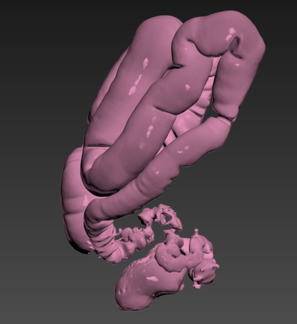 Thumbnail for Torso-Colon-Stricture