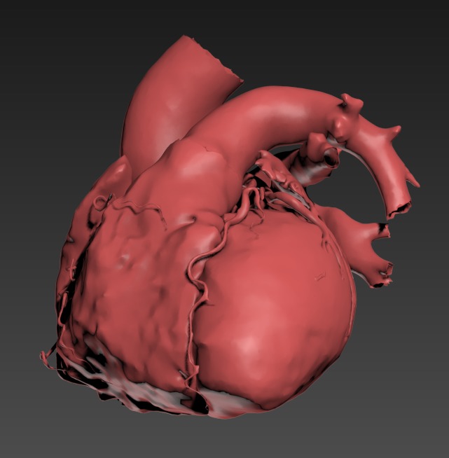 Thumbnail for Torso-Heart-Few-Layers