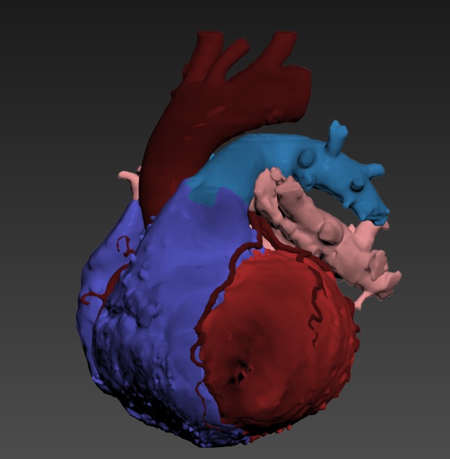 Thumbnail for Torso-Heart-More-Layers