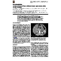 Thumbnail for An unusual cause …
