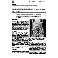 Thumbnail for Acute Typhlitis in …
