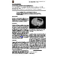 Thumbnail for Isotretinoin-associated acute pancreatitis