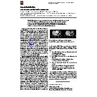 Thumbnail for Metastatic Merkel Cell …